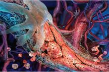 Ученые изобрели гель, «заклеивающий» поврежденные сосуды